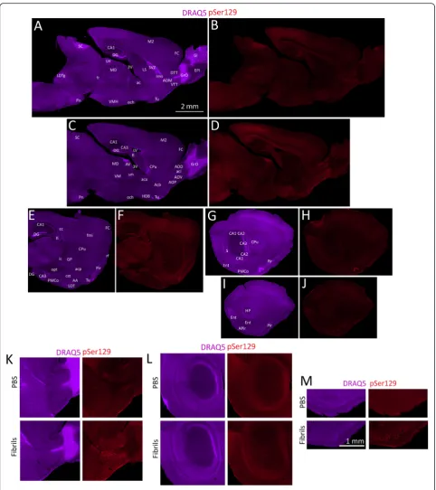 Fig. 4 αbe fully examined for background staining in Additional file 1: Figure S8. The scale bar forthe neuroanatomical sublocalization, the reader must zoom in and out of the stitched pSer129 montages in the high-resolution versions of these filesat the l