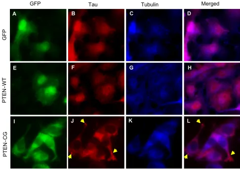 Figure 4The phosphatase activity null PTEN leads to formation of visible tau aggregates in cellsThe phosphatase activity null PTEN leads to formation of visible tau aggregates in cells