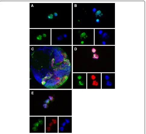 Figure 6 Symmetrically dividing optic lobe precursors are maintained in culture. (A, B) Proliferating cells shown by BrdU incorporation(green) and DAPI staining (blue), after 15 h in culture