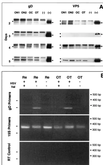 FIG. 5. (A) The viral envelope glycoprotein is delivered to the axon 2 days before the capsid protein is recognized in the axon