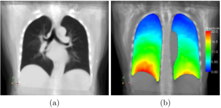 Fig. 1. Visualization of average lung model ¯ I 0 (a) and magnitude of mean deformation