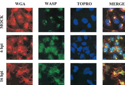 FIG. 7. VV infection changes the subcellular localization of WASP from the Golgi complex