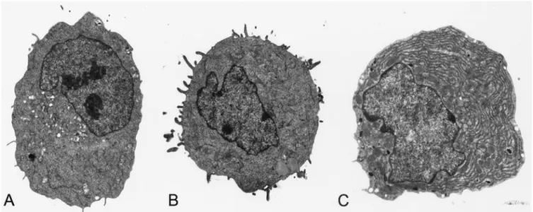 Fig. 5. Electron micrographs of the myeloma (A), 164 lymphoblast (B), and hybridoma that produces monoclonal antibodies against HIV (C)