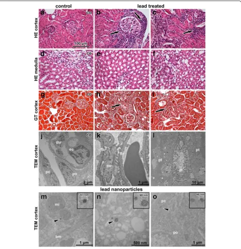 Fig. 8 Effect of inhalation of lead oxide nanoparticles on kidney following 6 weeks exposure.microscope