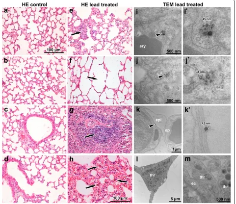 Fig. 3 Effect of inhalation of lead oxide nanoparticles on lung following 6 weeks exposure