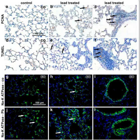 Fig. 4 Immunostaining of lung samples following 6 weeks exposure to PbO-NPs. a-c PCNA in lung tissue