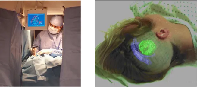 Figure 2.27: Left: Monitor-based navigation system for image-guided neurosurgery. Right: