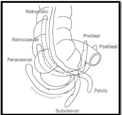 Figure 2. Normal variant anatomical positions of the appendix