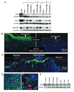 Figure 1. Examination of XOR expression in wounds and keratinocytes. (A) Western blot anal-ysis for XOR, iNOS and arginase I expression in mouse skin, wound edge and granulation tis-sue is shown