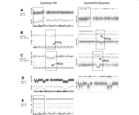 Figure 1 Examples of microarray-based genomic profiles.loss of thelog2 ratio and smoothened log2 ratio in case 21