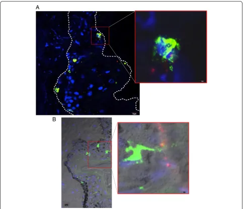 Fig. 6 Langerhans cells co-localized with QD in the skin epidermis. Skin cryosections were imaged using the confocal laser-scanning microscope.a Immunofluorescence (IF) image showing a Langerhans cell co-localized with a QD cluster near the stratum corneum