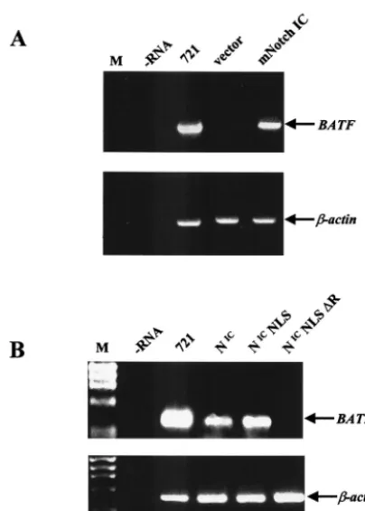 FIG. 5. The and controlnuclear import signal (Nthe CBF1 interaction domain. RNA for 721 B cells served as a positivecontrol