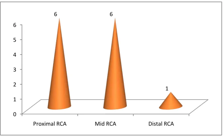 Fig 20Segment wise distribution of stenosis in RCA 