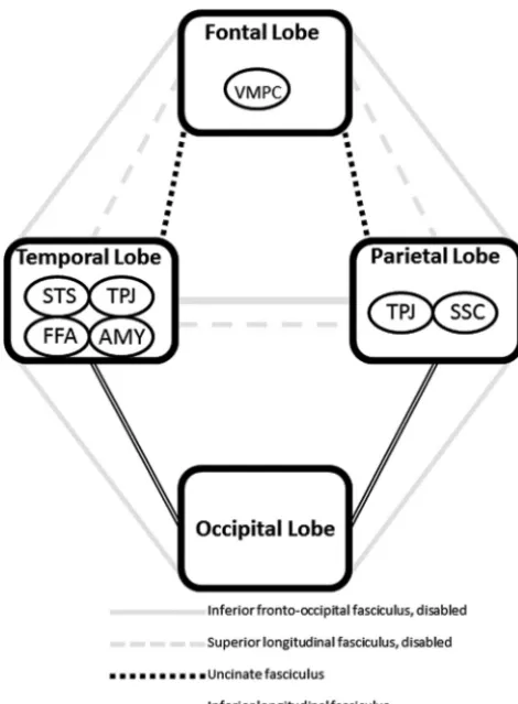 Fig 3. Schematic diagram illustrating how the inferior fronto-occipital and superiorlongitudinal fasciculi might account for the social disability that characterizes autism.Disability of major pathways connecting the modules of the social brain causes reli