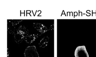 FIG. 4. Membrane-bound HRV2 is concentrated in coated pits.(A) HeLa-H1 cells were transfected with a GFP-clathrin light-chain A