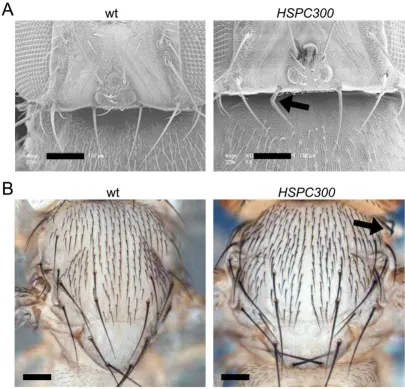 Figure 6Bristle phenotypeand HSPC300 HSPC300 Bristle phenotype. (a) Scanning electron microscope images of the dorso-posterior portion of the Drosophila head (b) light microscope images of thoracic bristles