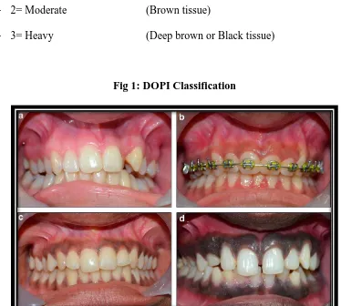 Fig 1: DOPI Classification 