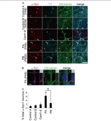 Figure 5 α-synuclein accumulation in PARK2 iPSC-derived neurons. (A–C) Triple labeling for α-synuclein (red), tyrosine hydroxylase(TH; cyan), and βIII-tubulin (green) along with Hoechst (blue) staining of control A (B7), control B (WD39), Cent1-8, and PARK