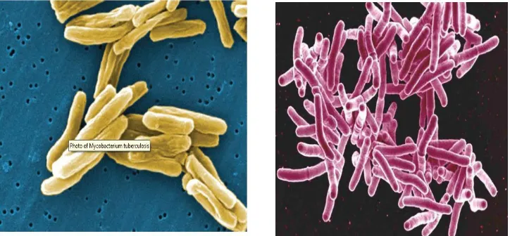 Figure 3: Cell wall of mycobacterium tuberculosis  (source: www.tuberculosis.com, ref 2) 