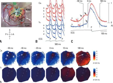 Fig. 1. Activation pattern of SAN and surrounding RA during isoproterenol infusion of 0.3 µmol/L