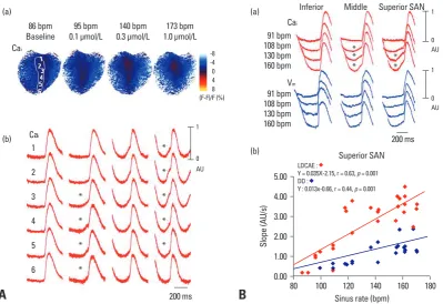 Fig. 2. Co-localization of LDCAE and the leading pacemaker site. (A) Upward shift of the leading pacemaker site with LDCAE during isopro-terenol infusion
