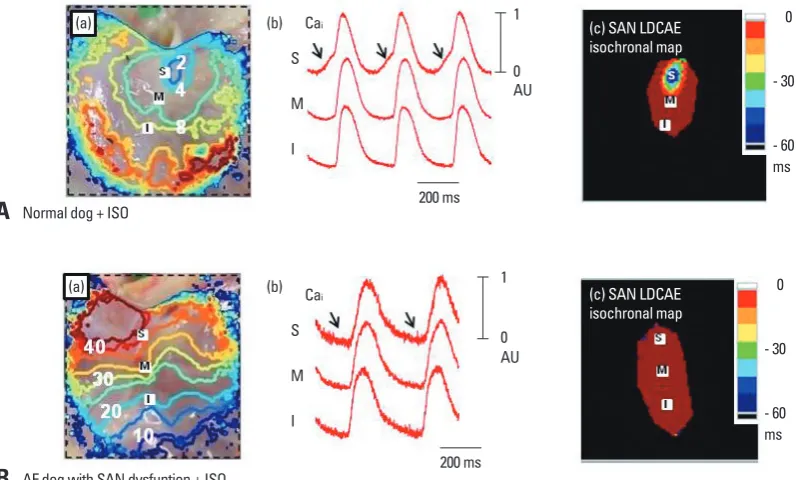 Fig. 3. Complete absence of LDCAE in AF dogs during isoproterenol infusion. (A) Isoproterenol response of normal dogs