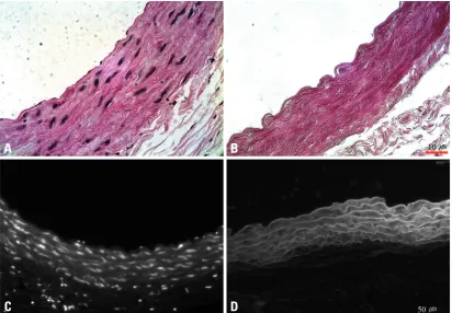 Fig. 2. Histologic assessment of the decellularized scaffold. (A) Normal aortic wall with a confluent endothelial cell lining and abundant cellularity in the native vascular wall matrix