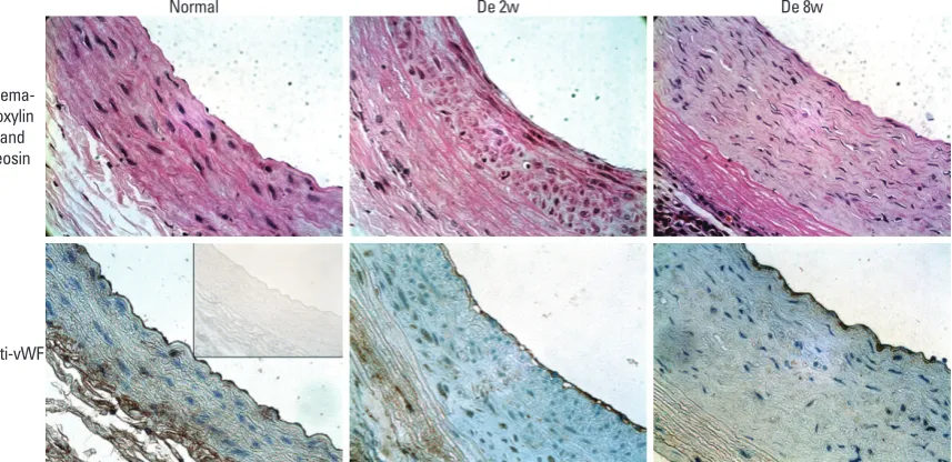 Fig. 3. Von Gieson’s stain (black, far left column) shows absence of elastin fibers within the intimal proliferative layer