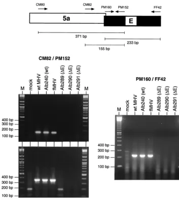 FIG. 5. RT-PCR analysis to rule out the presence of the E gene elsewhere in the genome