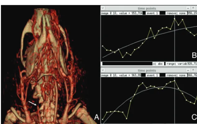 Fig 5. A, An axial section through a single phase of a 4D time-resolved image stack used for estimating brain perfusion