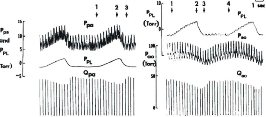 Fig. 2. Experimentally measured pulmonary and systemic artery pressures (P pa and Pao) and flow rates (Qpa and Qao) during mechanical ventilation, as shown by the variations in pleural pressure (Ppl) (Scharf et al., 1980)