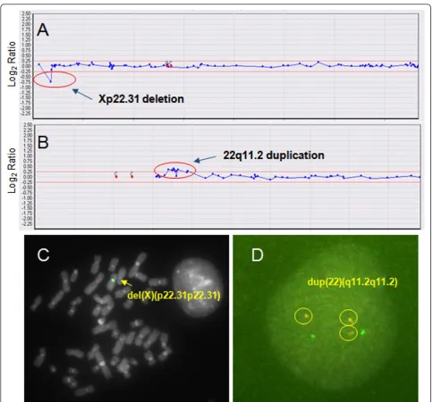 Figure 1 Array CGH with FISH validation data for cases 17 (A, C) and 21 (B, D) (Table 2)