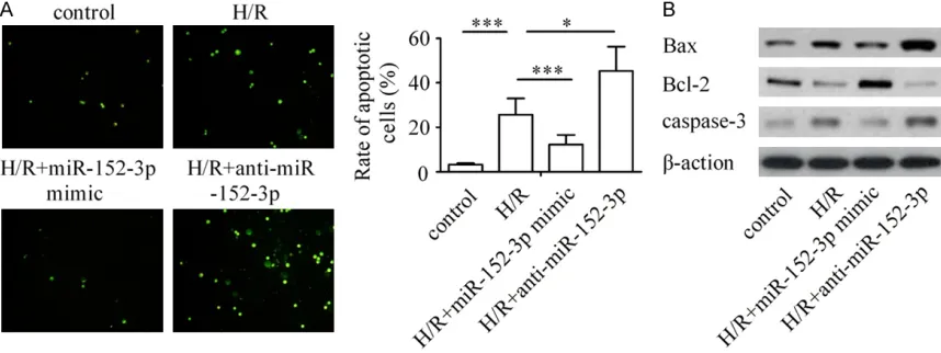 Figure 2. Effects of miR-152-3p on H/R-induced cardiomyocyte apoptosis. A: Ectopic expression of miR-152-3p attenuates cardiomyocyte apoptosis during H/R injury and its down-regulation promotes myocyte apoptosis