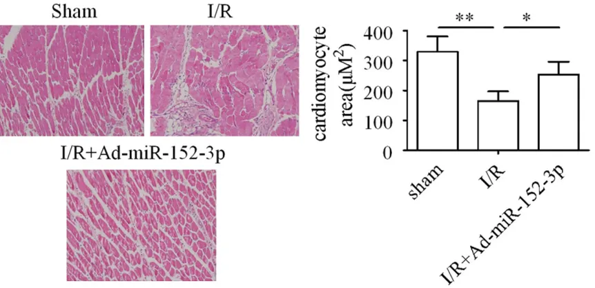 Figure 6. miR-152-3p exerts protective effect against myocardial I/R injury in vivo. (A) Expression of miR-152-3p was determined after myocardial I/R injury