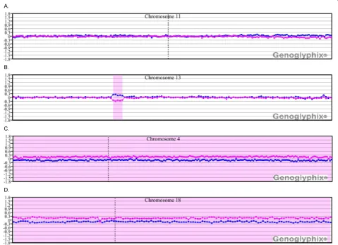 Figure 4 Microarray results for case 8 showing discordance between microarray and FISH