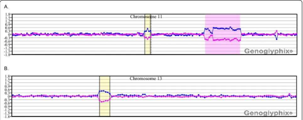 Figure 1 Microarray results for case 1. (A) Single-copy loss of probes at 11q14.1q11.23.2, approximately 28.9 Mb in size