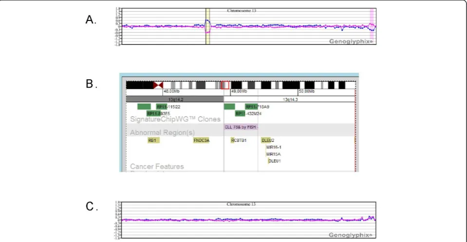Figure 2 Microarray characterization of a der(6)del(6)(q15q21)inv(6)(p21.3q23) in case 2