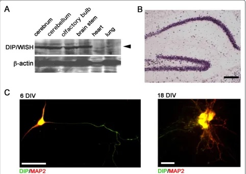 Figure 1 DIP/WISH protein expression in mouse brainlung of mice. (B) DIP/WISH mRNA expression in mouse hippocampus