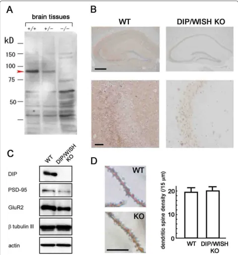 Figure 2 Absence of DIP/WISH in DIP/WISH-deficient neurons. (A) Absence of DIP/WISH protein in the brain from DIP/WISH-deficient mice.(B) Absence of DIP/WISH protein in the hippocampus from DIP/WISH-deficient mice