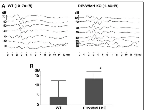 Figure 6 ABR analysis of WT and DIP/WISH-deficient mice. (A) ABR wave-forms were not substantially different between WT (10 to 80 dB)and DIP/WISH-deficient mice (0 to 80 dB) although there seemed to be a slight time elongation of wave-forms in DIP/WISH mic