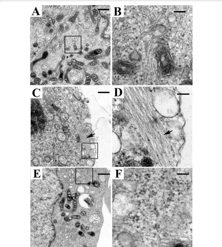 Figure 4 Electron micrographs of cultures with and without drug treatment. (A-D) Exposure to SB (10 mM) for 36 hs resulted in accumulation of filamentous aggregates in differentiated 3D5 cells with induced a-Syn expression