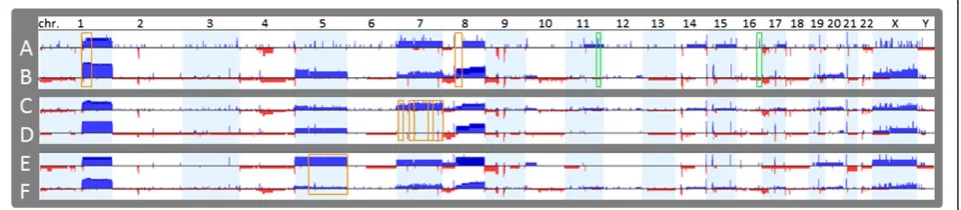 Figure 3 Frequency difference plot for gains and losses between groups in the comparison analysis.invasion (Figure 3(Figure 3 Comparison I: five of grade 1 and welldifferentiated HCCs (Figure 3A) vs ten of grade 2, 3 or 4 and moderately or poorly different