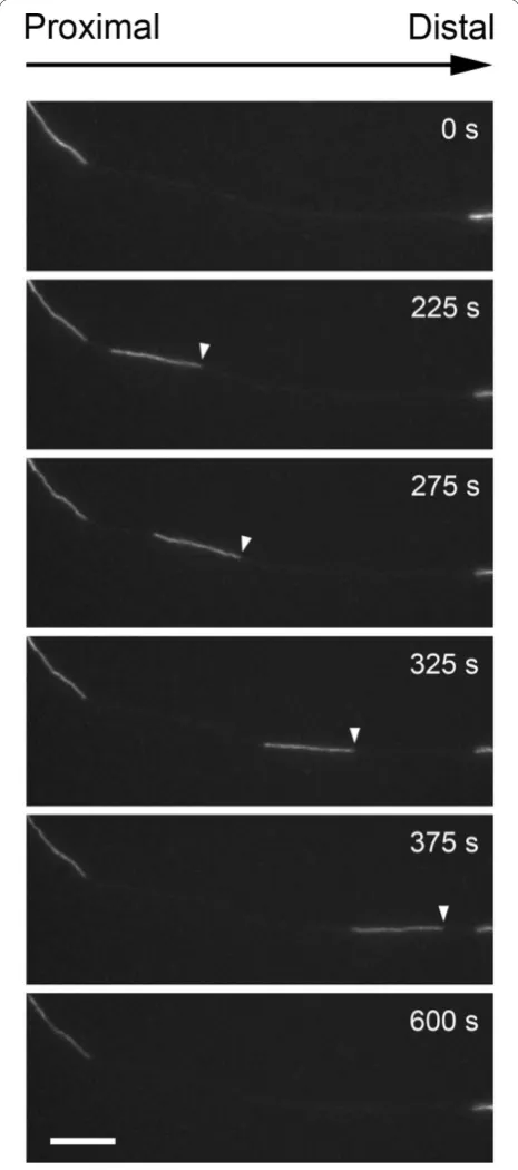Figure 2 A neurofilament moving through a gap in the axonalneurofilament array. Axon of a cortical neuron expressing GFP-NFM, visualized by epifluorescence microscopy