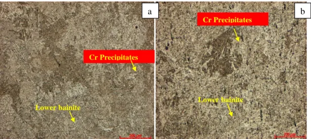 Figure 7: Microstructure of the sample without addition of AF. Magnification 100x and attack by immersion 12s in  Vilella (a) and Microstructure of the sample with 10% addition of AF