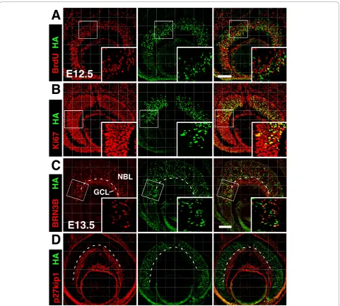 Figure 5 Expression of MATH5 in retinal progenitors and migrating RGCsdevelopmental stages were immunolabeled with anti-HA (green) to detect MATH5 and cell type-specific markers (red)