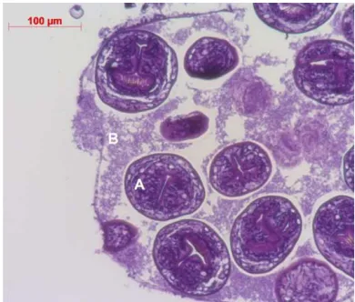 Fig. 2. Fresh mount of aspirate from representa-tive lung cyst. The unstained, unfixed materialwas imaged at 400x total magnification.Protoscolices with calcareous granules can beseen within the cyst fluid.