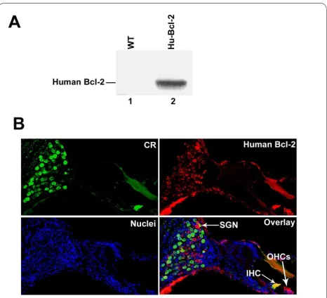 Figure 2 Comparison of age-related hearing loss between wild-type and bcl-2 transgenic mice