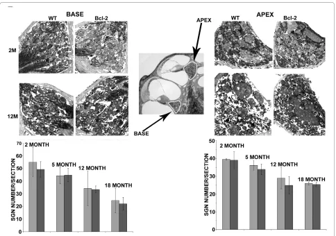 Figure 5 Comparison of age-related hearing loss between wild-type and Bax-/- mice. Mean (+SD) ABR thresholds were measured in both wild type (n = 3) and Bax-/- mice (n = 4)