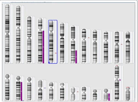 Figure 6 SNP-array results at the follow-up study showing loss of heterozygosity (LOH) of chromosome 14, in addition to the LOHchromosomes 4, 7, and 22 found at initial diagnosis