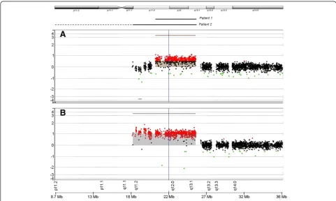 Figure 1 FISH analysis of patient 2. (A) 2 green and 2 red hybridization signals were seen on the larger marker corresponding to centromeric15 (D15Z1) and SNRPN respectively (B) 1 green and 1 red hybridization signals were seen on the smaller marker corresponding to centromeric 15(D15Z1) and SNRPN respectively (Abbreviations: FISH: Fluorescent in situ hybridization, SNRPN: Small nuclear ribonucleoprotein polypeptide N).